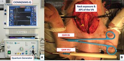 Safety Parameters of Quantum Molecular Resonance Devices During Thyroid Surgery: Porcine Model Using Continuous Neuromonitoring